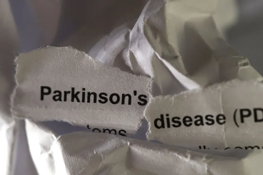 Parkinson's disease. 